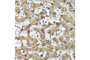 Immunohistochemistry of paraffin-embedded human liver using MAK antibody (ABIN7268382) at dilution of 1:100 (40x lens). (MAK 抗体  (AA 370-435))