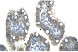 Human Intestine; ZNF498 antibody - middle region in Human Intestine cells using Immunohistochemistry (Zinc Finger and SCAN Domain Containing 25 (ZSCAN25) (Middle Region) 抗体)