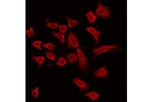 ABIN6269391 staining MDA-MB-435 by IF/ICC. (ASK1 抗体  (N-Term))