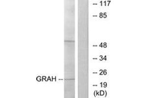 Western blot analysis of extracts from K562 cells, using GRAH Antibody.