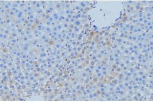 ABIN6273742 at 1/100 staining Mouse liver tissue by IHC-P. (CYP7A1 抗体  (Internal Region))