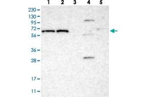 Western blot analysis of Lane 1: RT-4, Lane 2: U-251 MG, Lane 3: Human Plasma, Lane 4: Liver, Lane 5: Tonsil with IFFO2 polyclonal antibody . (IFFO2 抗体)