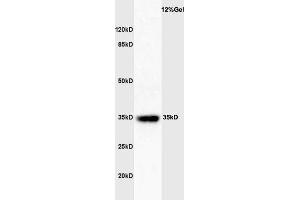 Mouse spleen lysates probed with Rabbit Anti-GATA-1 Polyclonal Antibody  at 1:3000 90min in 37˚C. (GATA1 抗体  (AA 251-350))