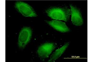 Immunofluorescence (IF) image for anti-Seryl-tRNA Synthetase (SARS) (AA 1-514) antibody (ABIN562797)