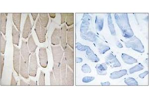 Immunohistochemistry analysis of paraffin-embedded human heart tissue, using MARCH3 Antibody. (MARCH3 抗体  (AA 111-160))