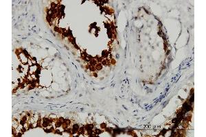 Immunoperoxidase of monoclonal antibody to ART3 on formalin-fixed paraffin-embedded human testis. (ART3 抗体  (AA 29-138))
