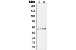Western blot analysis of Kv1. (KCNA1 抗体  (Center))