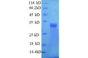 SDS-PAGE (SDS) image for Laminin, beta 2 (Laminin S) (LAMB2) (AA 1530-1798), (partial) protein (His tag) (ABIN5712898) (LAMB2 Protein (AA 1530-1798, partial) (His tag))