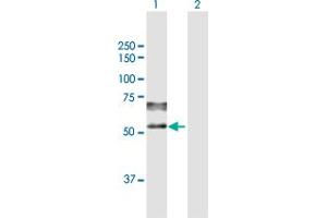 Western Blot analysis of PSAP expression in transfected 293T cell line by PSAP MaxPab polyclonal antibody. (Prosaposin 抗体  (AA 1-524))