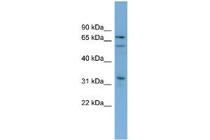 WB Suggested Anti-TBX18 Antibody Titration:  0.
