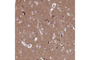 Immunohistochemical staining of human cerebral cortex with SGIP1 polyclonal antibody ( Cat # PAB28015 ) shows distinct cytoplasmic positivity in a fraction of neuronal cells at 1:10 - 1:20 dilution. (SGIP1 抗体)