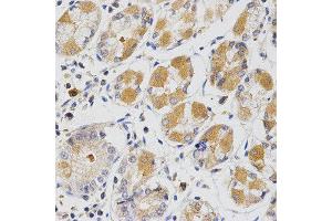 Immunohistochemistry (IHC) image for anti-Glutaredoxin 1 (GRX1) antibody (ABIN1876503) (Glutaredoxin 1 抗体)
