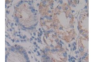 Detection of NPHN in Human Stomach Tissue using Polyclonal Antibody to Nephrin (NPHN) (Nephrin 抗体  (AA 23-92))