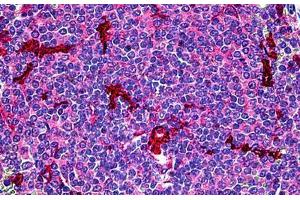 Human Spleen: Formalin-Fixed, Paraffin-Embedded (FFPE) (C5AR1 抗体)