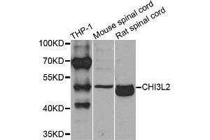 Western blot analysis of extracts of various cell lines, using CHI3L2 antibody (ABIN5975154) at 1/1000 dilution. (CHI3L2 抗体)
