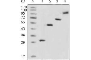 Western Blot showing GFP antibody used against recombinant GFP fusion protein (1) and various recombinant fusion protein with GFP tag (2, 3, 4). (GFP 抗体)