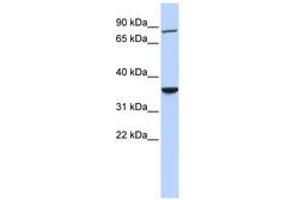 Image no. 1 for anti-RING Finger Protein 207 (RNF207) (AA 36-85) antibody (ABIN6740830) (RNF207 抗体  (AA 36-85))