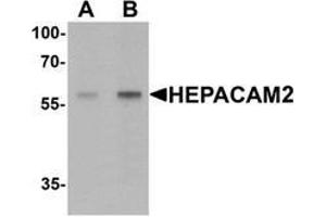 Western blot analysis of HEPACAM2 in mouse brain tissue lysate with HEPACAM2 Antibody  at (A) 0. (HEPACAM2 抗体  (C-Term))