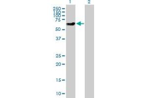 Western Blot analysis of XRCC4 expression in transfected 293T cell line by XRCC4 MaxPab polyclonal antibody. (XRCC4 抗体  (AA 1-336))