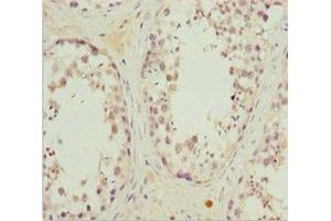Immunohistochemistry of paraffin-embedded human testis tissue using ABIN7167215 at dilution of 1:100 (MRAS 抗体  (AA 79-208))