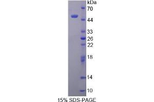 Image no. 1 for Peripheral-Type Benzodiazepine Receptor (TSPO) (AA 1-169) protein (His tag,GST tag) (ABIN4990827) (TSPO Protein (AA 1-169) (His tag,GST tag))