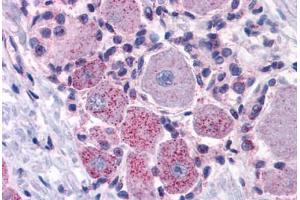 Anti-MRGPRX2 / MRGX2 antibody  ABIN1049077 IHC staining of human spinal cord, dorsal root ganglion. (MRGPRX2 抗体  (Extracellular Domain))