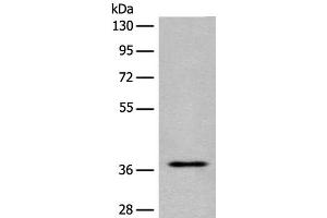 Western blot analysis of Jurkat cell lysate using EN2 Polyclonal Antibody at dilution of 1:400 (EN2 抗体)