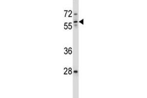 ICAM3 antibody western blot analysis in ZR-75-1 lysate. (ICAM-3/CD50 抗体  (AA 282-310))