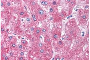 Immunohistochemistry (Paraffin-embedded Sections) (IHC (p)) image for anti-serpin Peptidase Inhibitor, Clade A (Alpha-1 Antiproteinase, Antitrypsin), Member 1 (SERPINA1) antibody (ABIN290682)