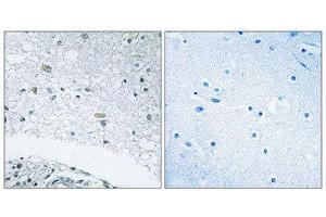 Immunohistochemistry (IHC) image for anti-Laminin, gamma 3 (LAMC3) (C-Term) antibody (ABIN1850460) (LAMC3 抗体  (C-Term))