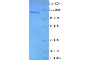 SDS-PAGE (SDS) image for Casein Kinase 2 alpha 1 (CSNK2A1) (AA 1-391), (full length) protein (His-SUMO Tag) (ABIN5709345)