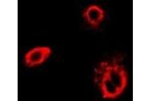 Immunofluorescent analysis of TCP1-delta staining in Hela cells. (CCT4 抗体)