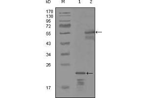 Western blot analysis using ERBB3 mouse mAb against truncated Trx-ERBB3 recombinant protein (1) and MBP-ERBB3 (aa1175-1275) recombinant protein (2). (ERBB3 抗体)
