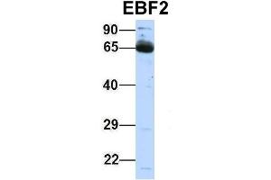 Host:  Rabbit  Target Name:  EBF2  Sample Type:  Human Fetal Lung  Antibody Dilution:  1. (EBF2 抗体  (Middle Region))