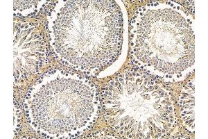 ABIN7096231 and ABIN7100293 at 1/100 staining rat testis tissue by IHC-P. (FAM83H 抗体)