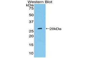 Western Blotting (WB) image for anti-Patched 1 (PTCH1) (AA 227-436) antibody (ABIN1860347) (Patched 1 抗体  (AA 227-436))