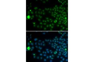 Immunofluorescence analysis of MCF-7 cells using SPDYA antibody. (SPDYA 抗体)