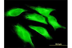 Immunofluorescence of monoclonal antibody to IL15 on HeLa cell. (IL-15 抗体  (AA 49-162))
