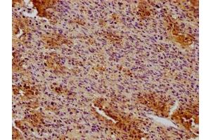 IHC image of ABIN7147134 diluted at 1:100 and staining in paraffin-embedded human spleen tissue performed on a Leica BondTM system. (CD19 抗体  (AA 20-291))