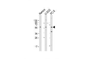 Western Blot at 1:2000 dilution Lane 1: Ramos whole cell lysate Lane 2: U-2OS whole cell lysate Lane 3: PC-3 whole cell lysate Lysates/proteins at 20 ug per lane. (TRIM6 抗体  (N-Term))