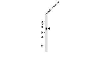 Anti-WNT11 Antibody (Center) at 1:2000 dilution + human skeletal muscle lysate Lysates/proteins at 20 μg per lane. (WNT11 抗体  (AA 166-198))