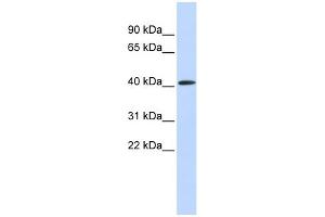 WB Suggested Anti-PAntibody Titration:  0. (PARP11 抗体  (Middle Region))