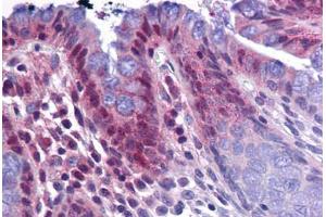 Immunohistochemistry (Formalin-fixed Paraffin-embedded Sections) (IHC (fp)) image for anti-Karyopherin alpha 3 (Importin alpha 4) (KPNA3) (C-Term) antibody (ABIN625982)