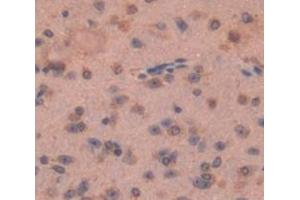 Used in DAB staining on fromalin fixed paraffin- embedded Kidney tissue (FZD1 抗体  (AA 112-317))