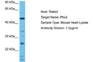 Host:  Mouse  Target Name:  PBX2  Sample Tissue:  Mouse Heart  Antibody Dilution:  1ug/ml (PBX2 抗体  (N-Term))