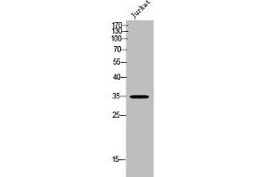 Western Blot analysis of JK cells using OSR2 Polyclonal Antibody (OSR2 抗体  (Internal Region))