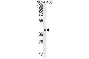 CCNYL3 Antibody (N-term) western blot analysis in NCI-H460 cell line lysates (35µg/lane). (CCNYL3 抗体  (N-Term))