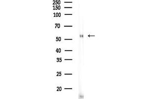 Western blot analysis of lysates from Mouse liver, using E Antibody at 1/1000 dilution.