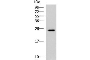 Western blot analysis of Hela cell lysate using GINS3 Polyclonal Antibody at dilution of 1:800