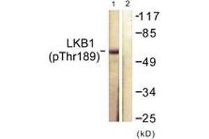Western blot analysis of extracts from NIH-3T3 cells treated with PMA 125ng/ml 30', using LKB1 (Phospho-Thr189) Antibody. (LKB1 抗体  (pThr189))